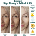 Retinol 3.5% Face Serum for Smoother-Looking Skin | Ammuri Beauty