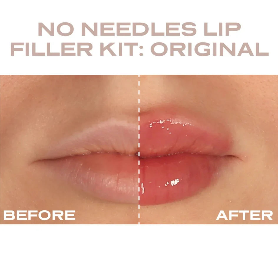 Plump It! - No Needles Lip Filler Kit Transparent 2 x 3 ml Instant Fix