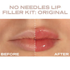 Plump It! - At Home Clinic Box