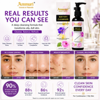 Mattifying Facial Cleanser for Oily & Combination Skin (100ml) | Ammuri